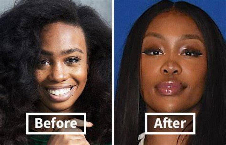 A Comprehensive Guide For SZA Before Surgery
