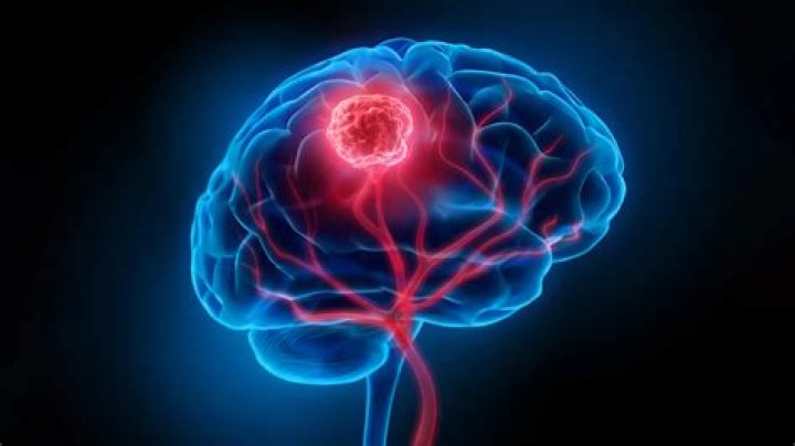 Andrea Mitchell Brain Tumor: Debunking the Rumors