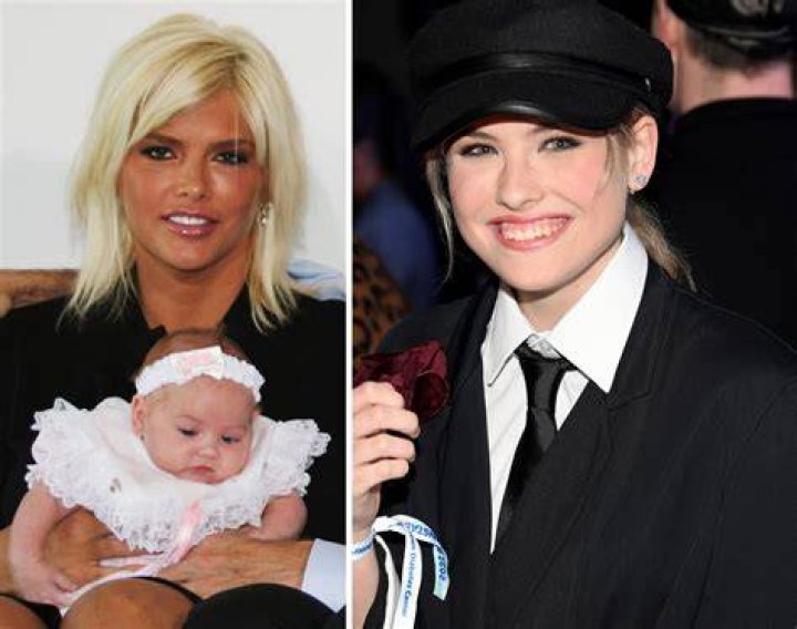 Anna Nicole Smith's Daughter's Disability Journey