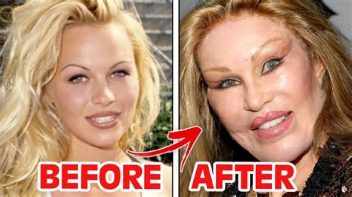 Belle Mariano Before And After Plastic Surgery Pics, Age And Husband Revealed