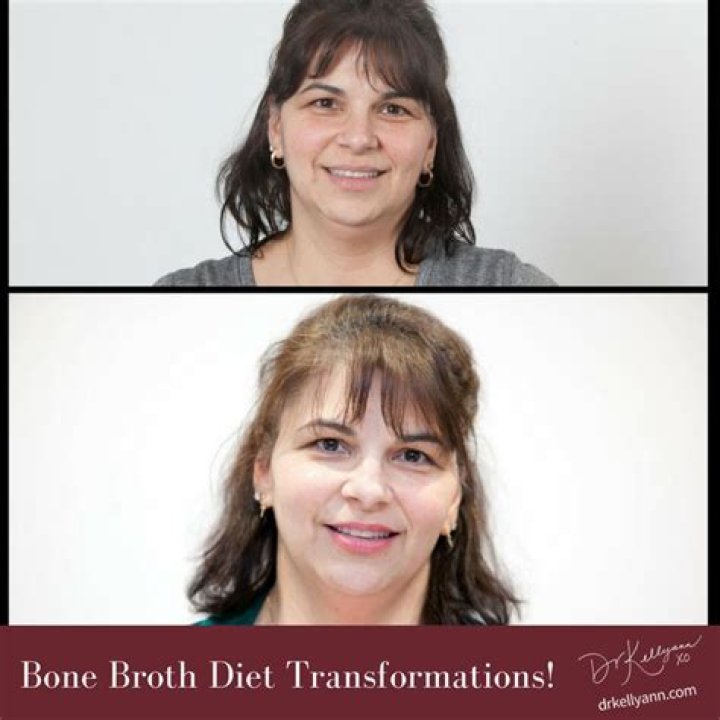 Bone Broth Skin Before And After