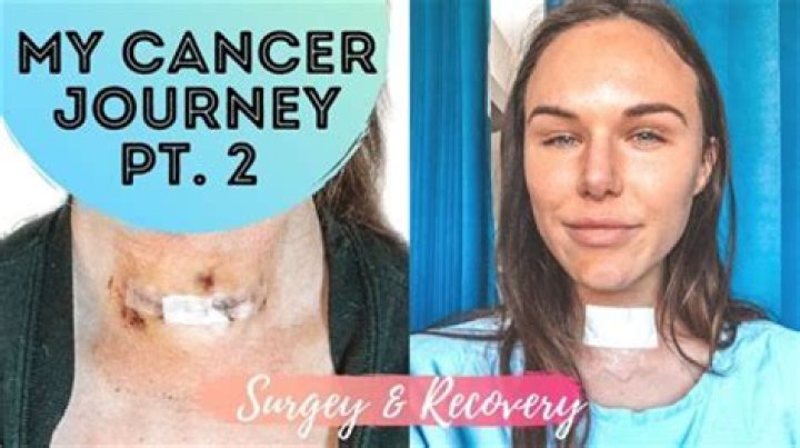 Discoveries And Insights: Joyce Vance's Thyroid Journey