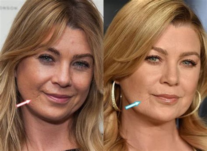 Ellen Pompeo Scars: A Journey Through Challenges and Triumphs
