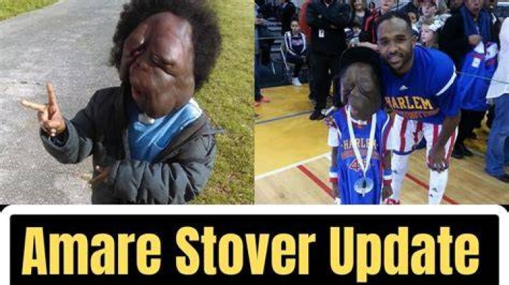 Is Amare Stover Still Alive