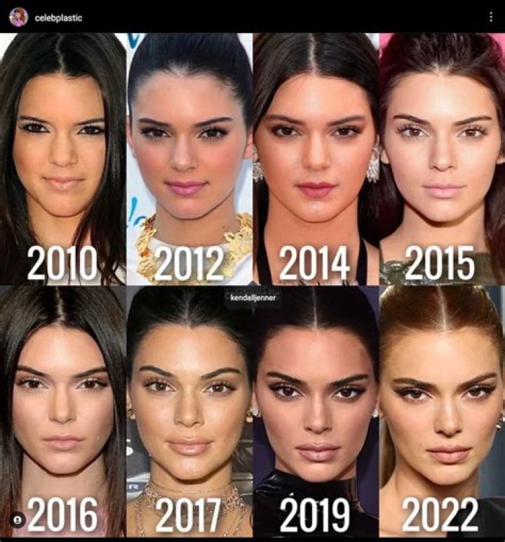 Kendall Jenner: A Comprehensive Exploration of Her Life and Career