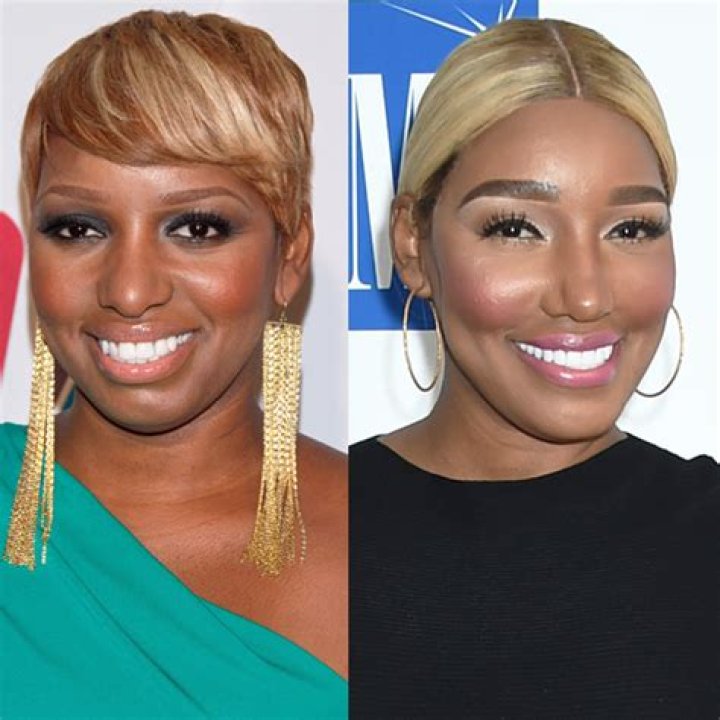 NeNe Leakes Spills Plastic Surgery Confessions On Wendy Williams Hollywood Life