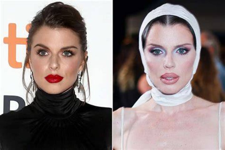 Plastic Surgery Twins: A Journey Of Transformation
