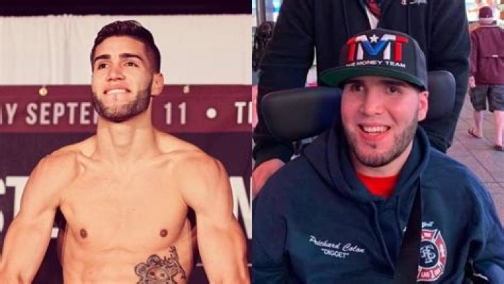 Prichard Colon Before And After: A Transformation Story