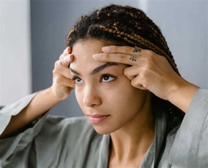 The Biggest Forehead in the World: A Fascinating Exploration