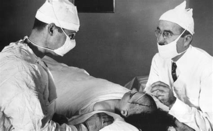 The Kennedy Lobotomy: A Controversial Chapter in Medical History