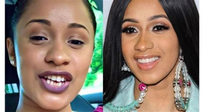 Unveiling Cardi B's Teeth Transformation: Before And After