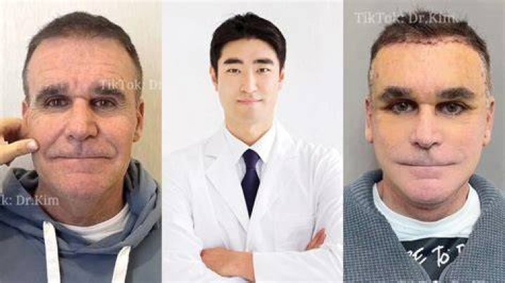 Unveiling Latto's Plastic Surgery Journey: Discoveries And Insights