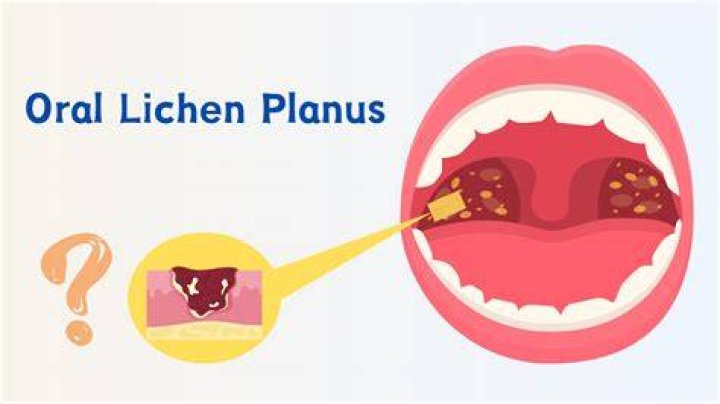 Unveiling The Multifaceted World Of Evelyn Linchen: Discoveries And Insights