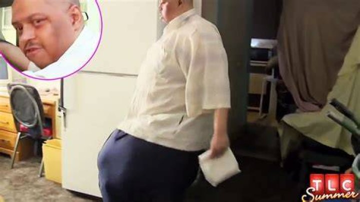 Wesley Warren, Man With 132-Pound Scrotum, Dies at 49