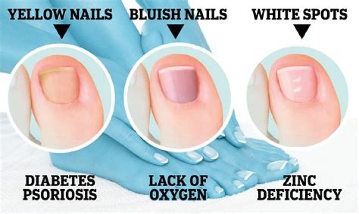 What Do White Toes Mean